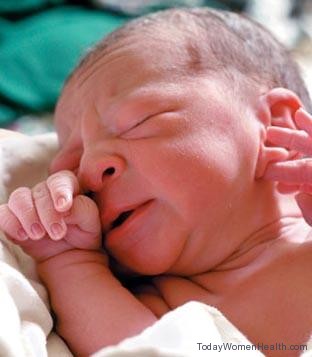الولادة القيصرية ام الولادة الطبيعية