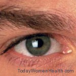 حساسية العين ما هى اسبابها وكيف يمكن الوقاية منها