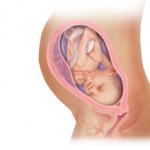  التهاب اللثة لدى الحامل