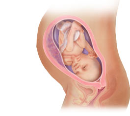 التهاب اللثة لدى الحامل