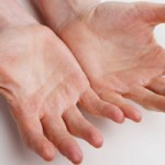 ما هو العلاج بضغط اليد؟