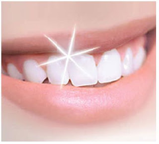 وصفات لتبييض الاسنان بين النفع والضرر