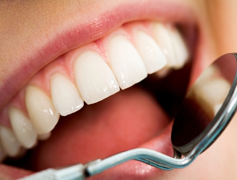 ما الفرق بين البلاك والجير على الاسنان