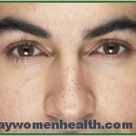 طرق التخلص من الرؤوس السوداء طرق التخلص من الرؤوس السوداء