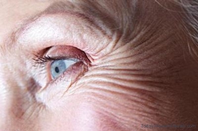 اسباب ظهور تجاعيد العين وكيف يمكن التخلص منها