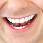 وسائل تبيض الأسنان دون اى ضرر للأسنان