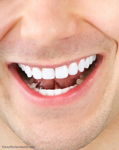 ما هى طرق تبيض الأسنان المختلفة ؟ وهل تؤدى الى ضرر الأسنان ؟