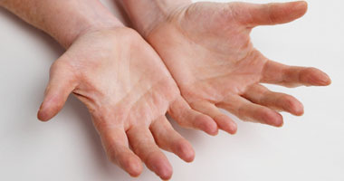 ما هو العلاج بضغط اليد؟