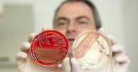 اكتشاف فيروس في البشرة يقضي على البكتيريا المسببة لحب الشباب