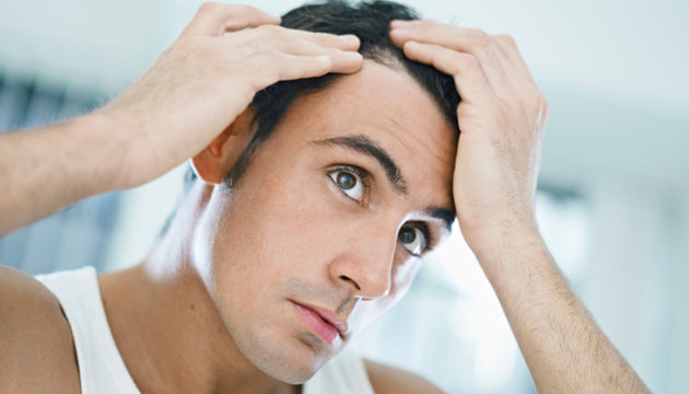 عشرة أسباب لتساقط شعر الرجل