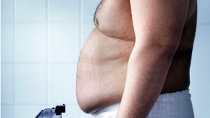 السمنة وزيادة الوزن قد تسبب نقص مستويات فيتامين (د)
