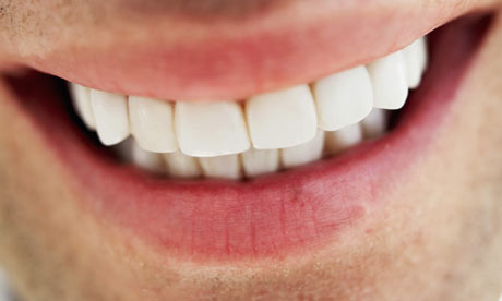 تبييض الاسنان - موقع صحتك اليوم