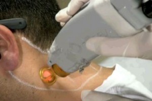 استخدامات الليزر الصحيحة