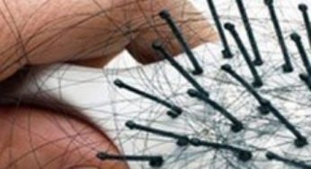 علاج تساقط الشعر بعد الحمل
