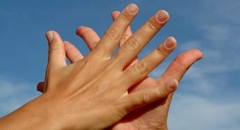 تعرق اليدين : الاسباب وطرق طبيعية للتخلص من التعرق الزائد لليدين