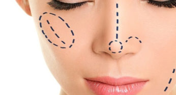 معلومات عن تجميل الأنف