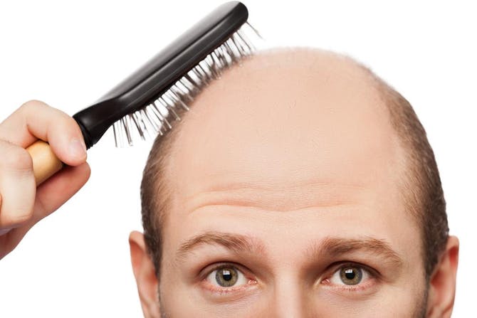 أسباب تساقط الشعر وعلاجه