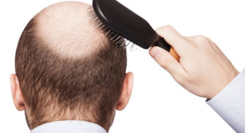 طرق لمنع تساقط الشعر وتكثيفه للرجال